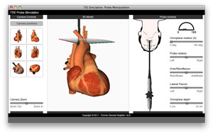 screen capture of TEE probe manipulation page